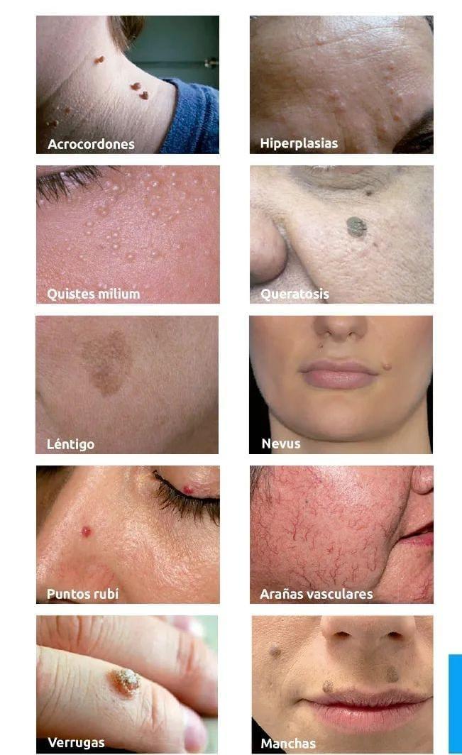 Tipologías comunes de lesiones cutáneas